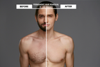 Wetty Pro Hair Removal Laser