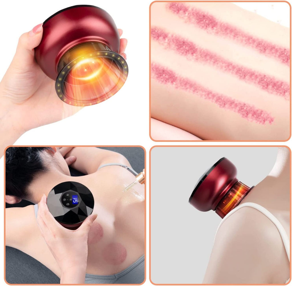 AgoKud Electric Cupping Therapy Set