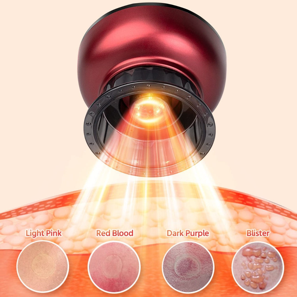 AgoKud Electric Cupping Therapy Set