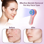 Electric Facial Cleansing Brush with 3 Operating Modes & 5 Replaceable Face Scrub Brush Heads, Waterproof Cleanser Remove Dirt, Oil, Makeup Residue, USB Rechargeable Facial Exfoliator & Massager (J02)